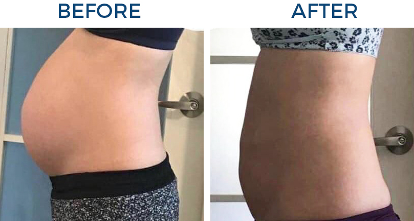 BELLY BINDING BEFORE AND AFTER 1