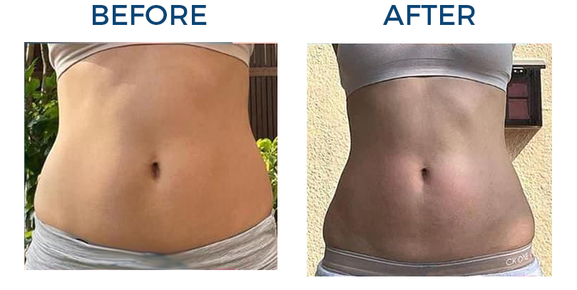 BELLY BINDING BEFORE AND AFTER 2
